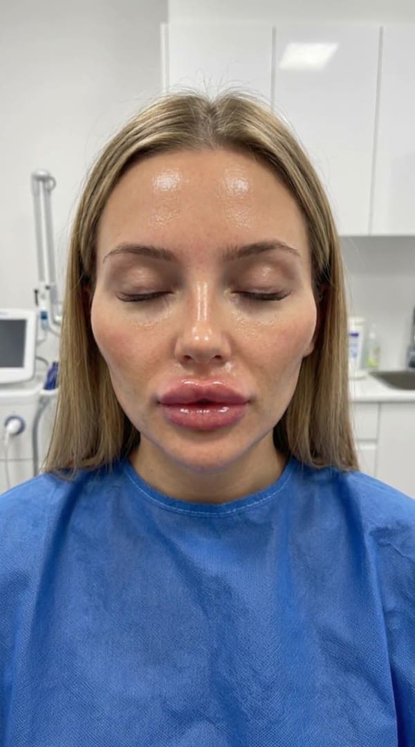 Plastic Surgery Overdose preview 2
